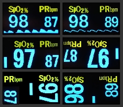 Pilot snímač pulzu a kyslíka-1